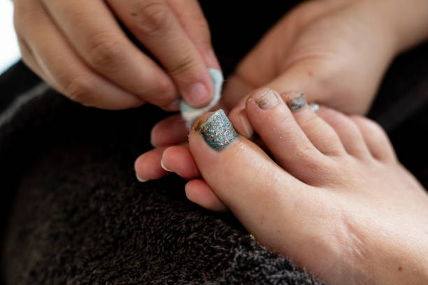 Removing nail polish from toenails